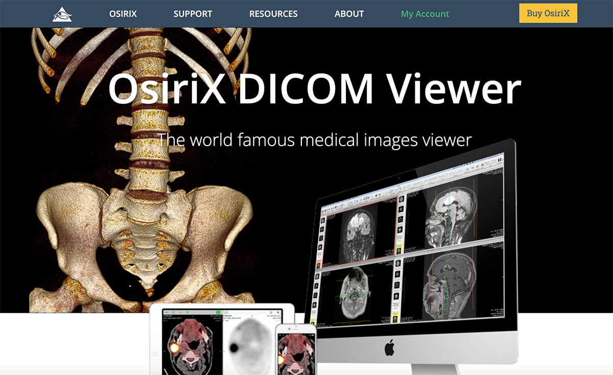 OsiriX DICOM Viewer（医学影像查看器）